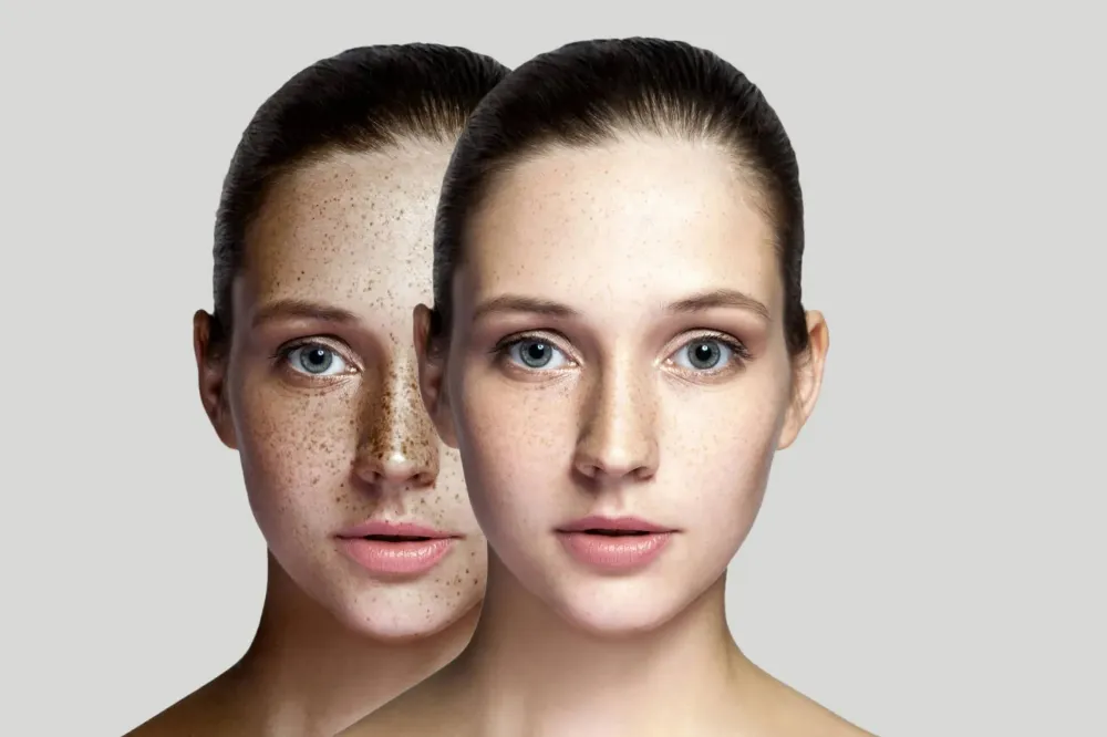 Dermatologie esthétique près de Pyrénées-Atlantiques