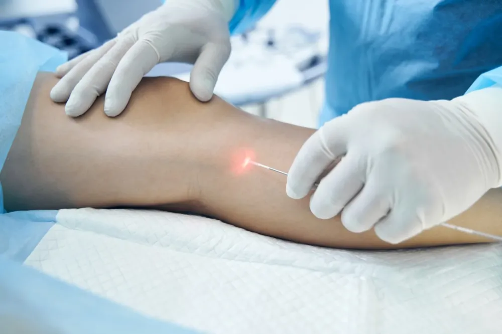 Laser endoveineux près de Pyrénées-Atlantiques